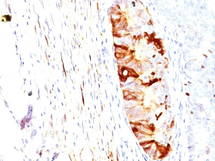 Anti-ALDH1A1 (Aldehyde Dehydrogenase 1A1)(ALDH1A1/1382) - image 1