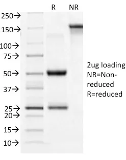 Anti-CD71 / Transferrin Receptor (TFRC)(TFRC/1396), CF640R conjugate - image 1