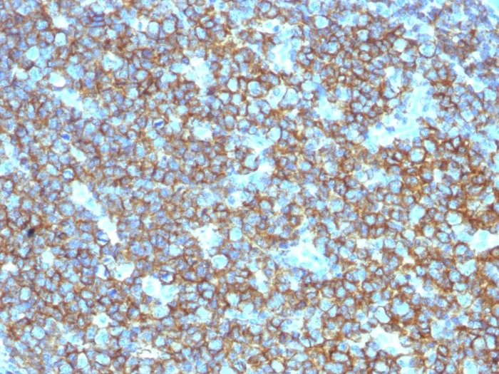 Anti-CD20 / MS4A1 (B-Cell Marker) - image 1