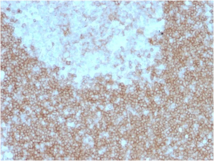 Anti-CD268 / BAFFR / TNFRSF13C(BAFFR/1557), CF594 conjugate - image 1