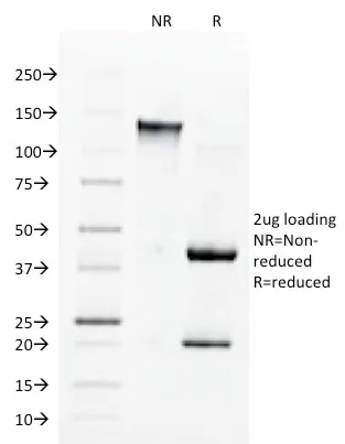 Anti-Angiotensin I Converting Enzyme (ACE) / CD143(9B9), CF640R conjugate - image 1