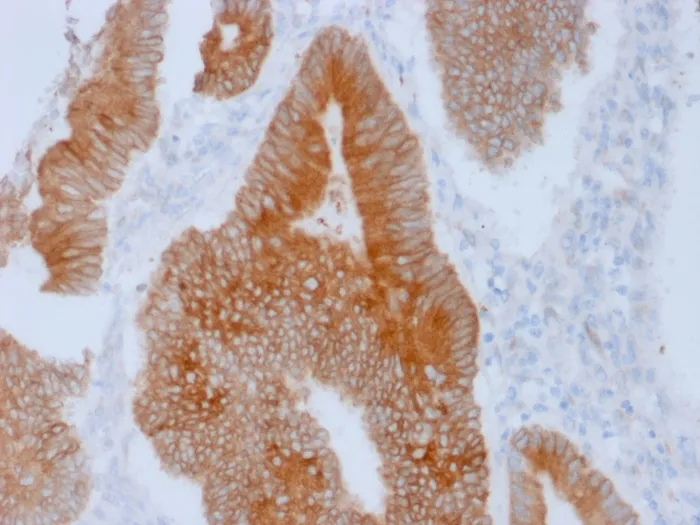 Anti-Aurora B (Proliferation Marker)(AURKB/1592) - image 1
