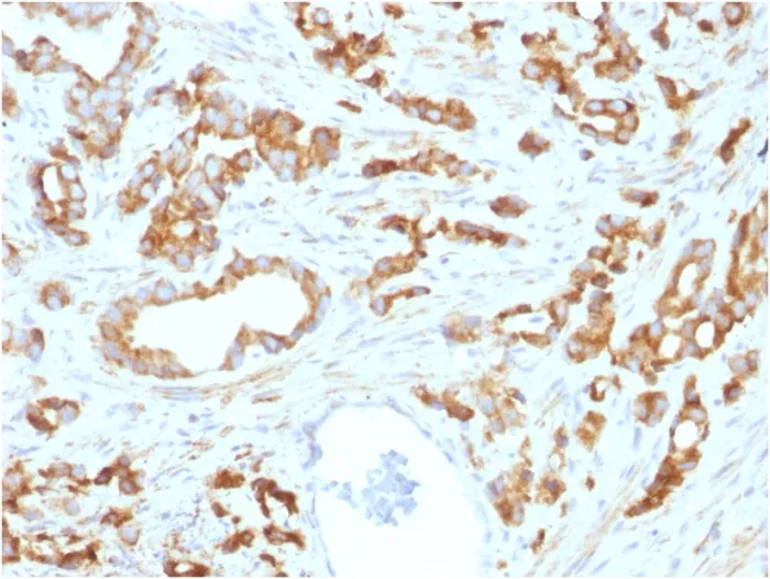 Anti-Aurora B (Proliferation Marker)(AURKB/1593) - image 1