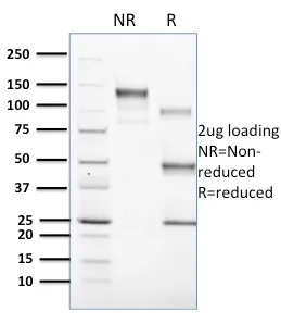 Anti-CD1c(CD1C/1603) - image 1
