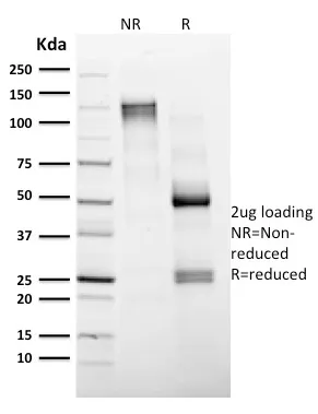 Anti-CD4 (T-Helper/Inducer Cell Marker)(CD4/1604) - image 1