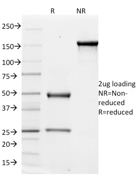 Anti-CD51 / Integrin V(ITGAV/1610) - image 1