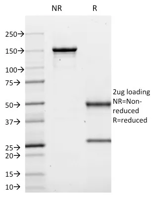 Anti-CD10 (Membrane Metalloendopeptidase)(MME/1620) - image 1
