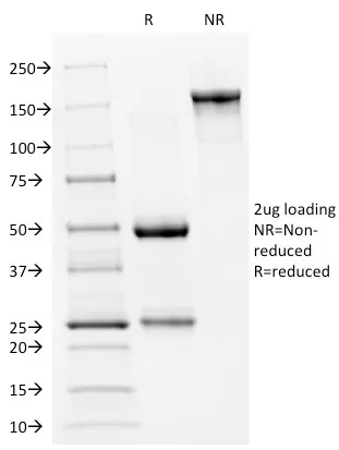 Anti-p53 Tumor Suppressor Protein(PAb240), Biotin conjugate - image 1