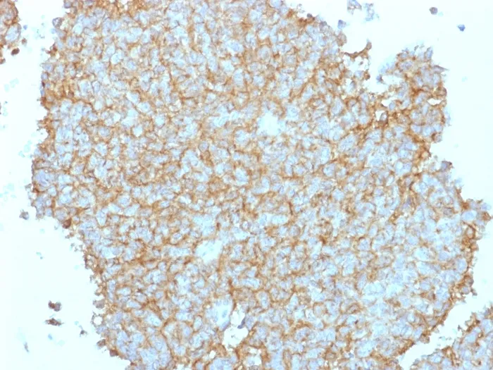 Anti-CD99 / MIC2 (Ewing's Sarcoma Marker), CF647 conjugate - image 1