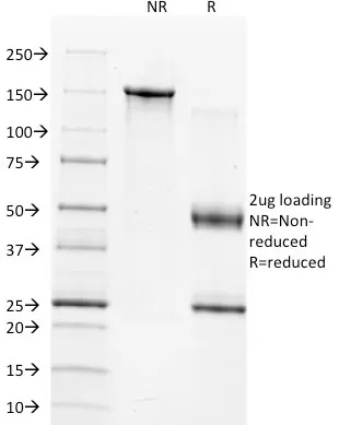 Anti-TIMP1 (Marker of Lymph Node Metastasis)(2A5), CF640R conjugate - image 1