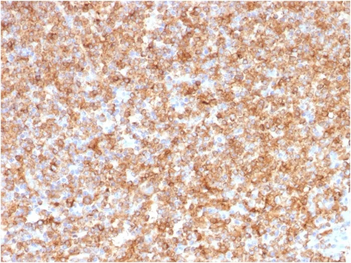 Anti-HLA-DP/-DQ/-DR (MHC II)(CR3/43), CF488A conjugate - image 1