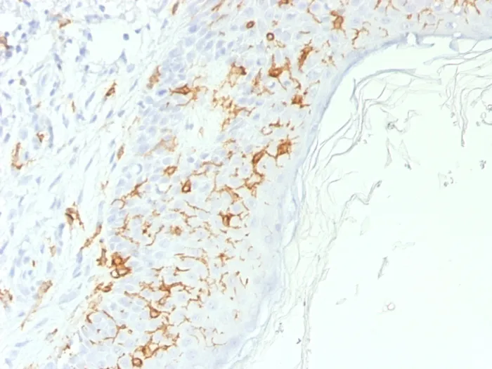 Anti-CD1a / HTA1 (Mature Langerhans Cells Marker), CF640R conjugate - image 1