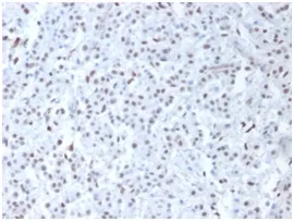 Anti-Wilm's Tumor 1 (WT1) (Wilm's Tumor & Mesothelial Marker) - image 1