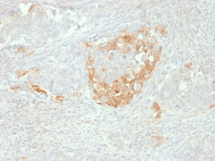 Anti-NSE gamma (Neuron Specific Enolase, gamma) (Neuroendocrine Marker)(NSE-P2), CF488A conjugate - image 1