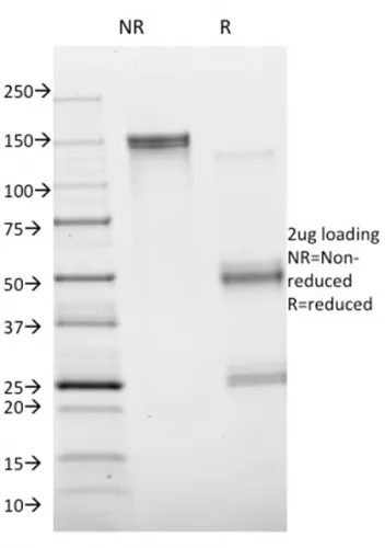 Anti-Annexin A1 / (Hairy Cell Leukemia Marker)(ANXA1/1672), Biotin conjugate - image 1