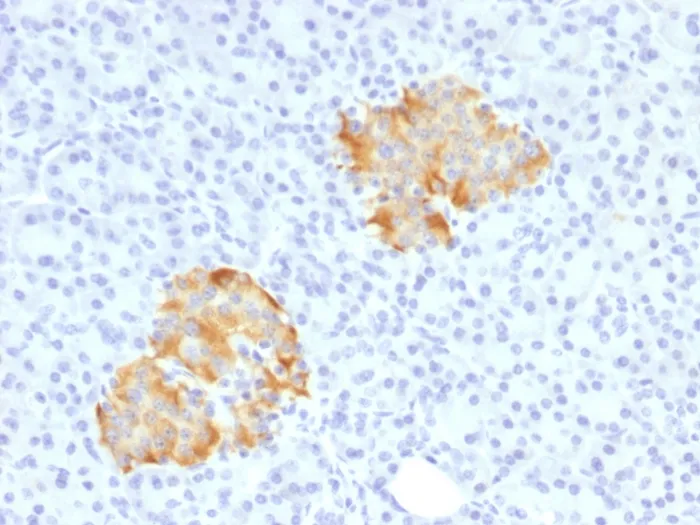 Anti-TNF-alpha (Tumor Necrosis Factor alpha) - image 1