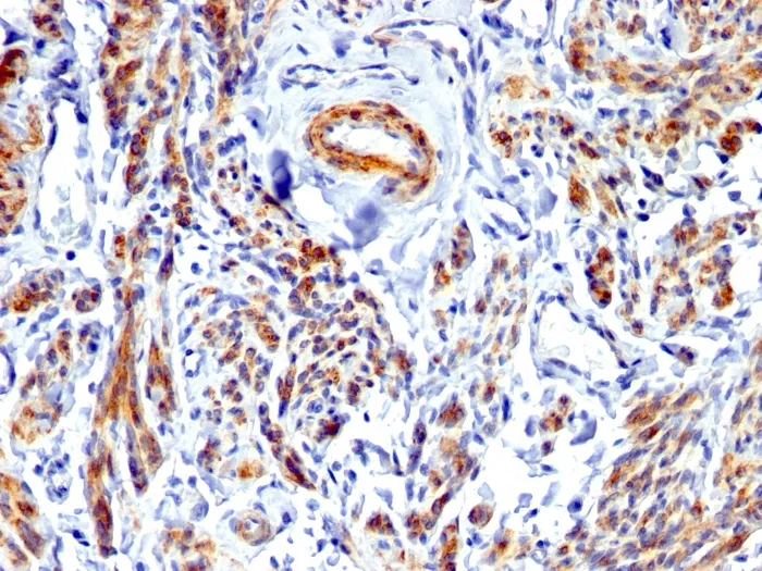 Anti-Caldesmon, HMW (h-Caldesmon) (Smooth Muscle Marker) - image 1
