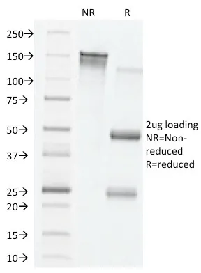 Anti-VEGF (Vascular Endothelial Growth Factor)(VG76e) - image 1