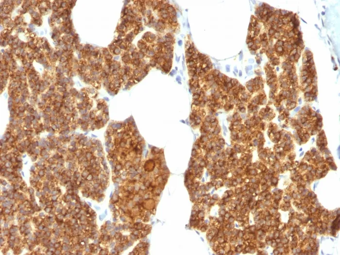 Anti-Parathyroid Hormone (PTH) (N-Terminal) - image 1