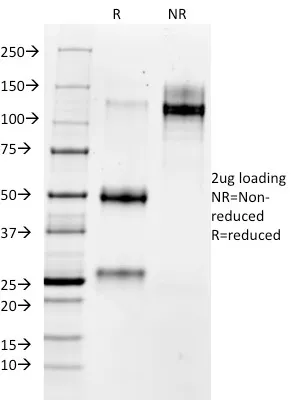 Anti-MMP3 (Marker of Metastasis and Rheumatoid Arthritis)(MMP3/1730) - image 1