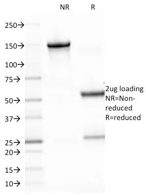 Anti-Epstein-Barr Virus (LMP-1)(CS2), Biotin conjugate - image 1