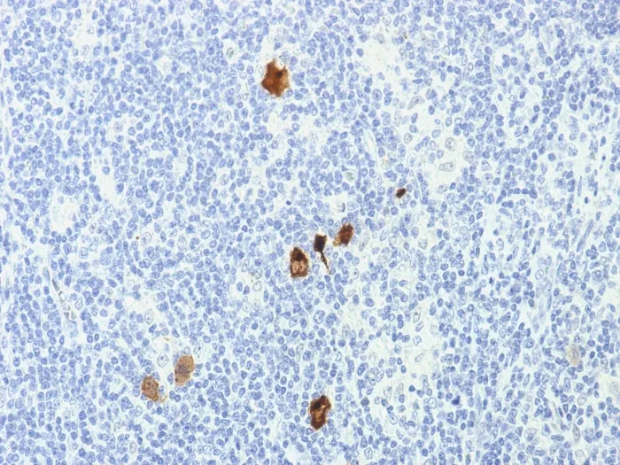Anti-Epstein-Barr Virus (LMP-1)(CS1-4), CF640R conjugate - image 1