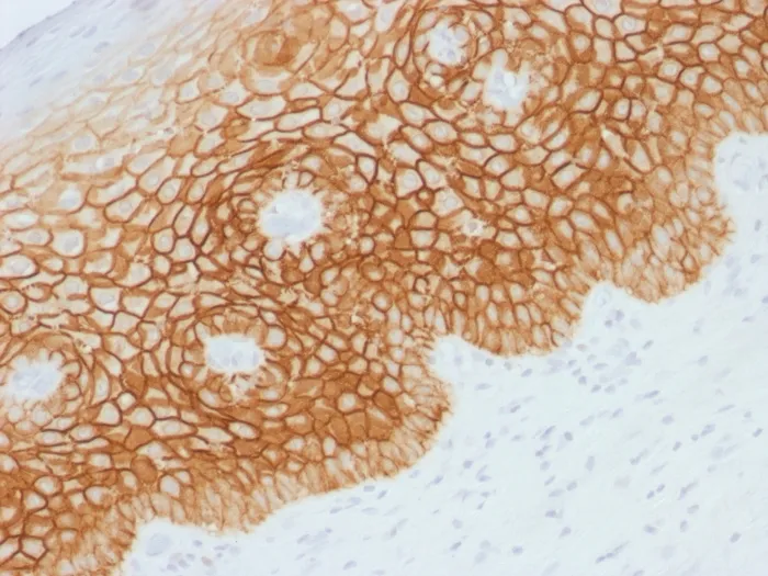 Anti-CD44v4 (Marker of Tumor Metastasis) - image 1