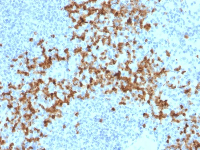 Anti-MMP9 (Matrix Metalloproteinase 9)(2C3) - image 1