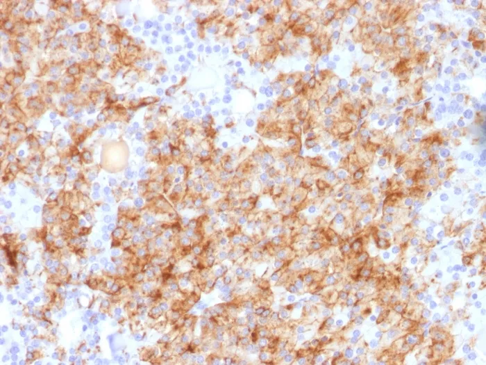 Anti-Chromogranin A / CHGA (Neuroendocrine Marker) - image 1