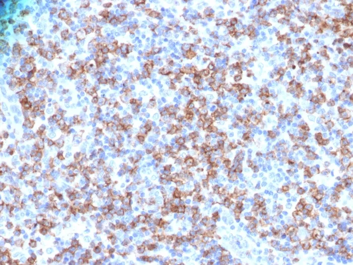 Anti-CD8A (Cytotoxic- & Suppressor T-Cell Marker)(N/A) - image 1