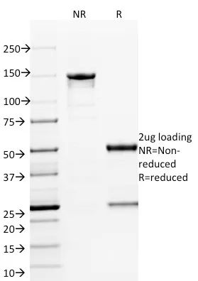 Anti-ETS1 (Marker of Tumor Metastasis)(ETS1/1801), CF640R conjugate - image 1
