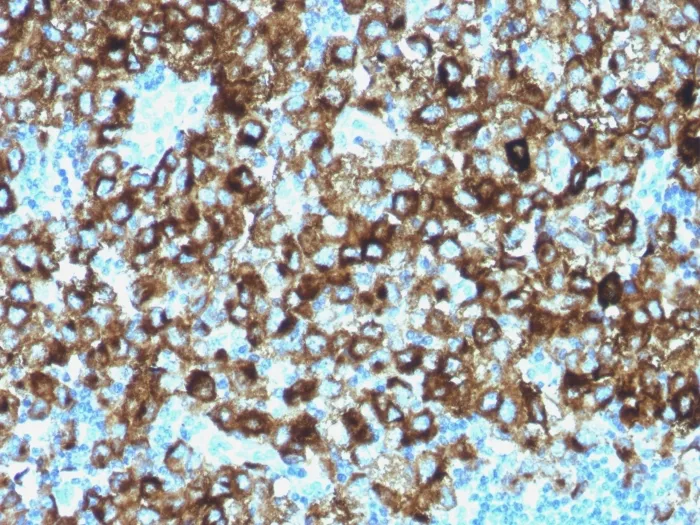 Anti-gp100 / Melanosome / PMEL17 / SILV (Melanoma Marker)(N/A), CF568 conjugate - image 1