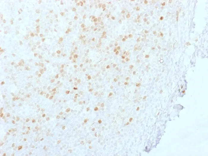 Anti-Aurora B (Proliferation Marker)(AURKB/1845) - image 1