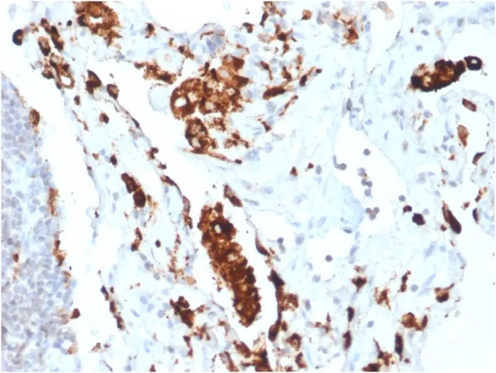 Anti-Napsin A (Lung Adenocarcinoma Marker)(NAPSA/1865R), CF405S conjugate - image 1