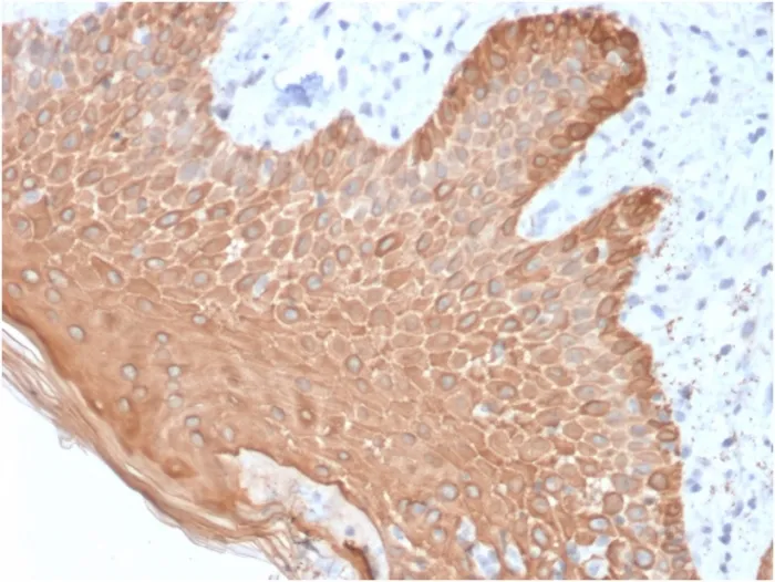 Anti-Cytokeratin, Multi (Epithelial Marker)(rKRT/457) - image 1