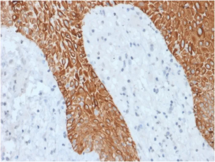 Anti-Cytokeratin, Multi (Epithelial Marker)(KRT/1877R) - image 1