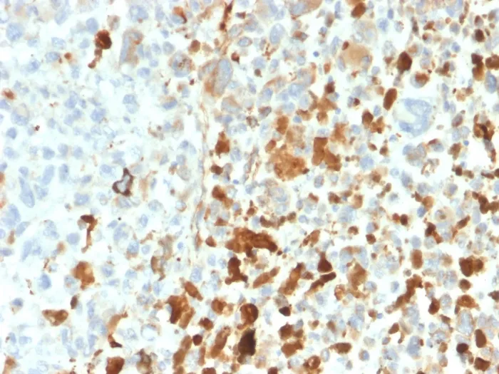 Anti-Vimentin (Mesenchymal Cell Marker)(VIM/1937R) - image 1