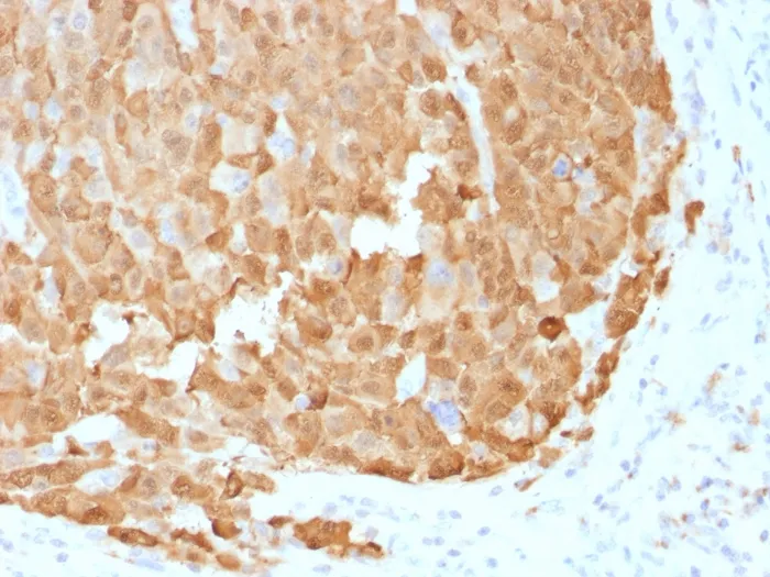 Anti-S100A1 (Melanoma Marker)(S100A1/1942), CF647 conjugate - image 1