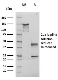 Anti-TIMP1 (Colorectal Cancer Biomarker / Marker of Lymph Node Metastasis)(rTIMP1/1710), CF594 conjugate - image 1