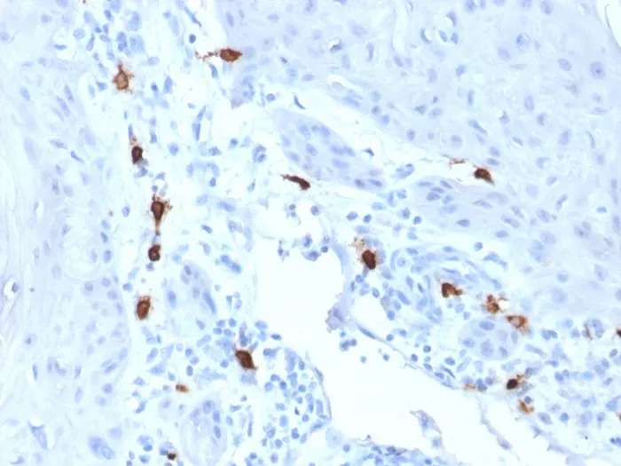 Anti-Tryptase (Mast Cell Marker)(TPSAB1/1963) - image 1