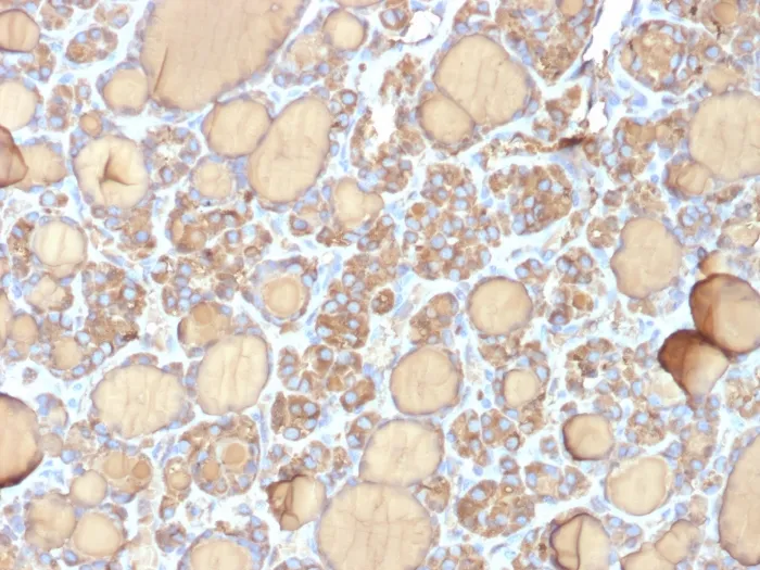 Anti-Thyroglobulin (Thyroidal Cell Marker)(r6E1) - image 1