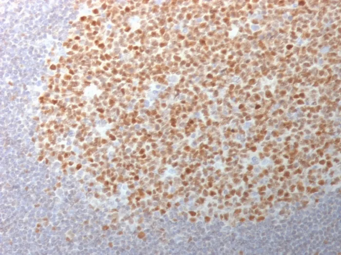 Anti-Bcl-6 (Follicular Lymphoma Marker)(BCL6/1982) - image 1