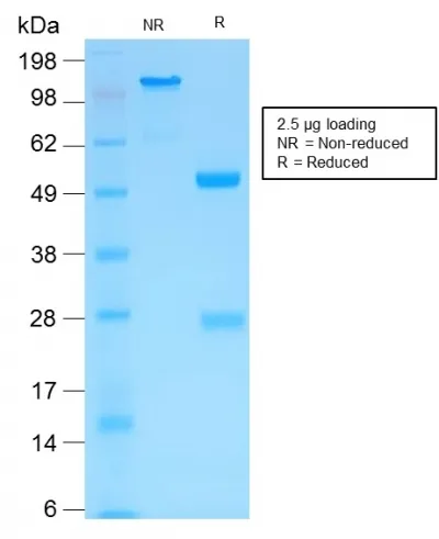 Anti-MMP3 (Marker of Metastasis and Rheumatoid Arthritis)(MMP3/1994R) - image 1