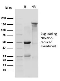 Anti-IL-10R1, Mouse (Interleukin-10 Receptor 1) (CD210)(1B1.3a), CF594 conjugate - image 1