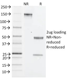 Anti-NK1.1 / CD161c / Klrb1c, Mouse(PK136) - image 1