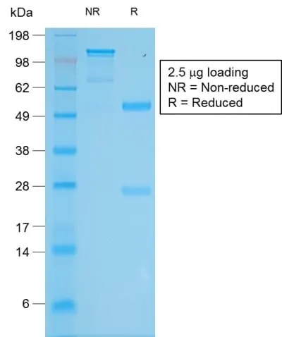 Anti-Tyrosinase (Melanoma Marker) (TYR/2024R) - image 2