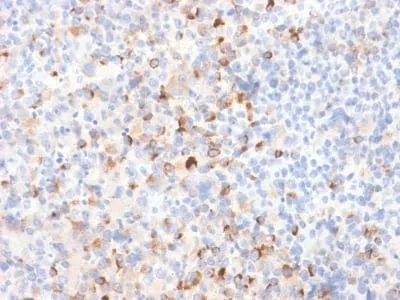 Anti-Tyrosinase (Melanoma Marker) (TYR/2024R) - image 1