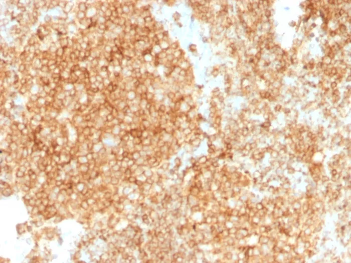 Anti-CD45 / LCA (Leucocyte Marker)(PTPRC/1147 + PTPRC/1460), Biotin conjugate - image 1