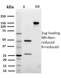 Anti-ARF1 (Golgi Apparatus Marker)(3F1) - image 1