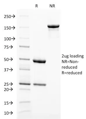 Anti-gp100 / Melanosome / PMEL17 / SILV (Melanoma Marker) (PMEL/2038) - image 3